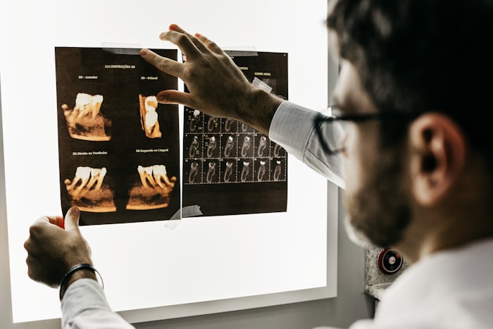 A surgeon reviewing X-ray images on a lightbox